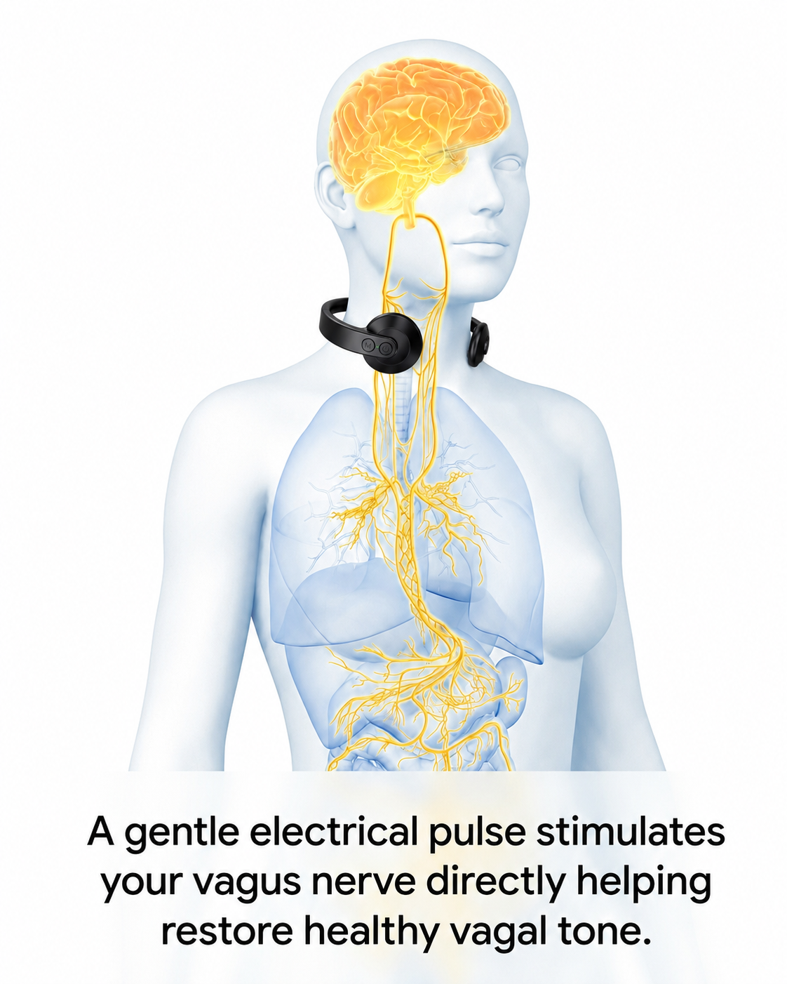 Vagus Nerve Stimulator